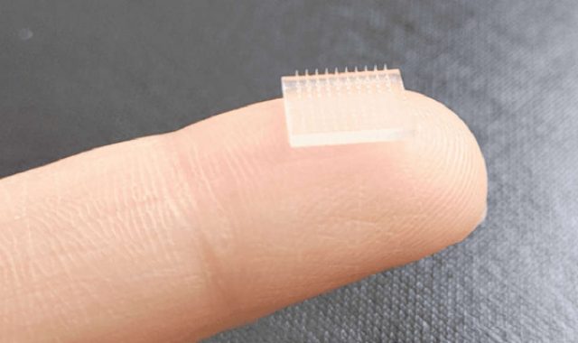 சுவிட்சர்லாந்தில்