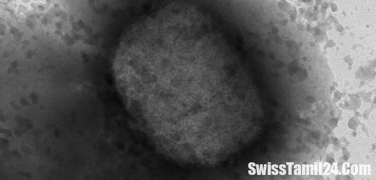 சூரிச் மண்டலத்தில் ஓரினச்சேர்க்கையாளர்களிடம் அதிகமாக பரவும் குரங்குகாய்ச்சல் நோய்.!!