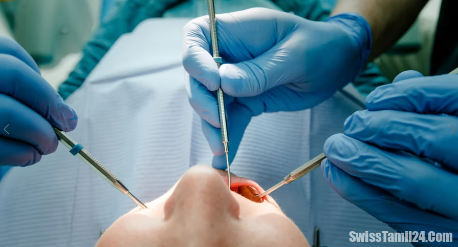 பல் மருத்துவர்கள் பலர் அதிக கட்டணம் வசூலிப்பதாக குற்றச்சாட்டு.!!