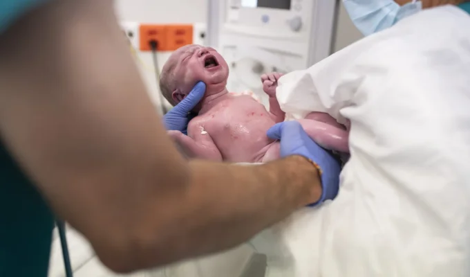 Rate of Caesarean sections in Switzerland is one of highest in Europe 1