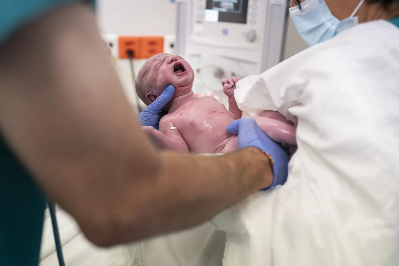 சுவிட்சர்லாந்தில் சிசேரியன் பிரசவ விகிதம் அதிகரிப்பு