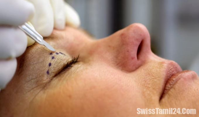 Falscher Arzt fuhrt in Zurich Schonheits