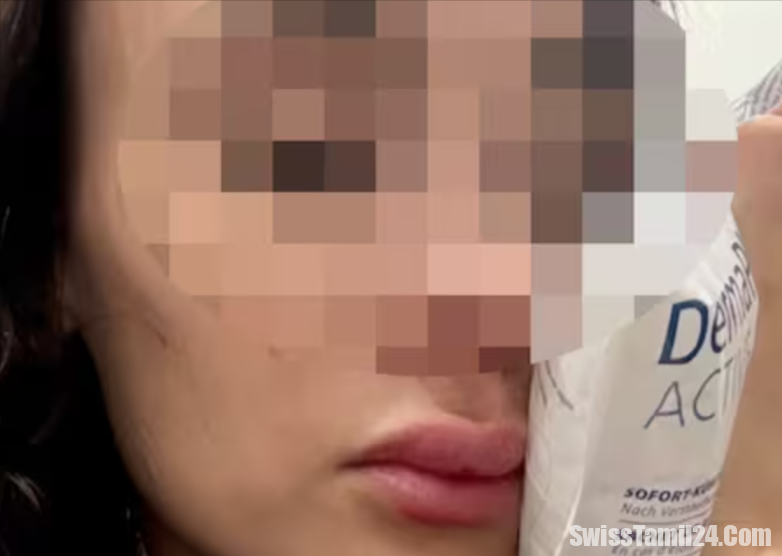 சூரிச் டிராமில் இளம் பெண் மீது தாக்குதல் – வீடியோ சமூக வலைதளங்களில் பெரும் பரபரப்பு